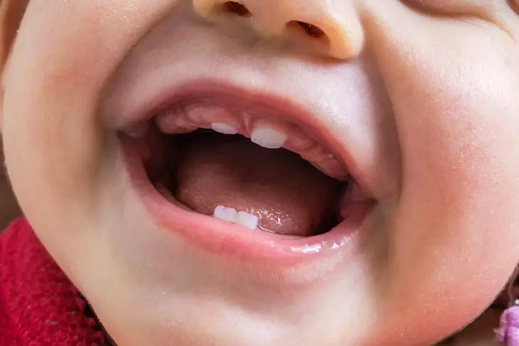 Baby Teeth Coming In Wrong Order
