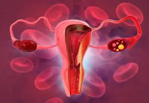 early ovulation after hsg