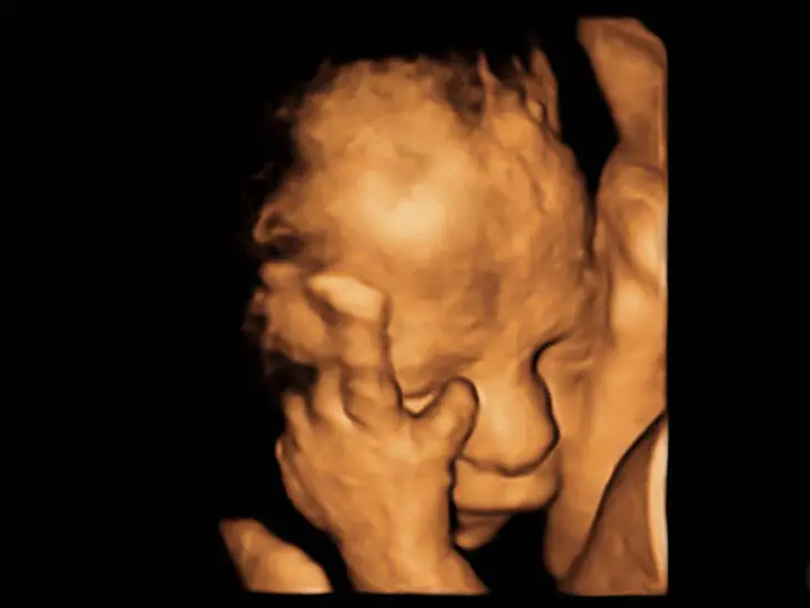 Is Baby Ultrasound Correct?