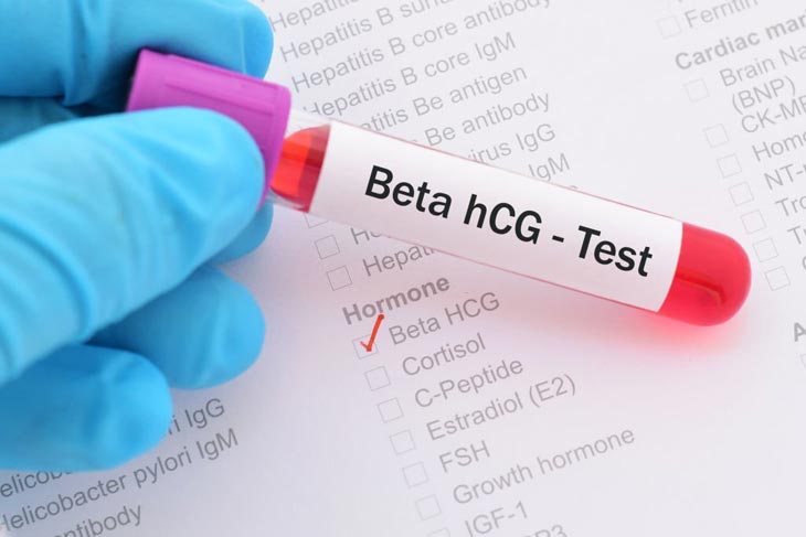 Beta Hormone hCG