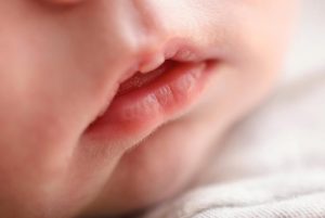Why Are Baby Lips Turning White?