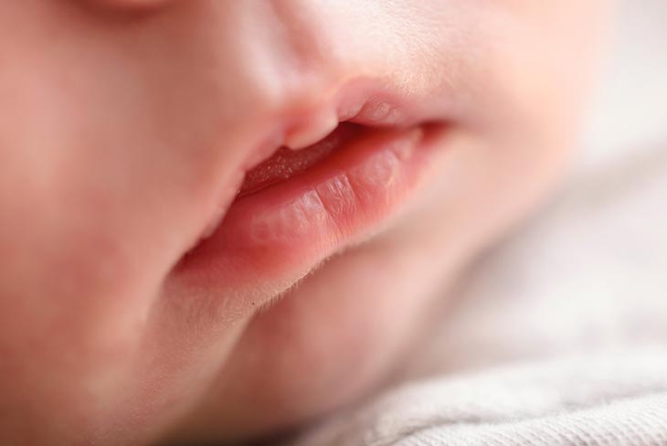 baby-lips-turning-white-2-causes-and-actionable-solutions