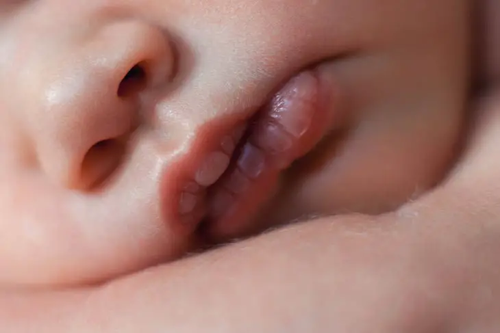 Baby Lips Turning White