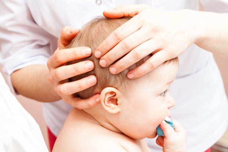 Dent In Baby Head After Fall