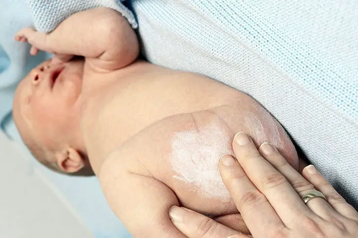 diaper rash red spots