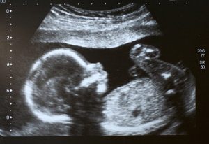What does fetal fraction mean