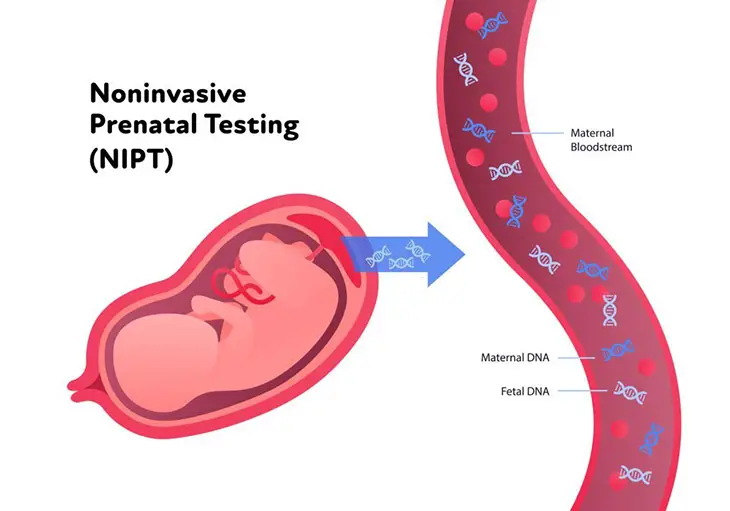 What is fetal fraction on NIPT