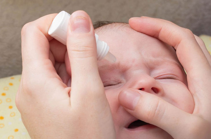 eye ointment at birth pros and cons