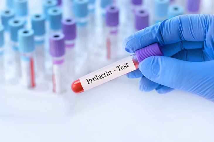 how does prolactin affect fertility