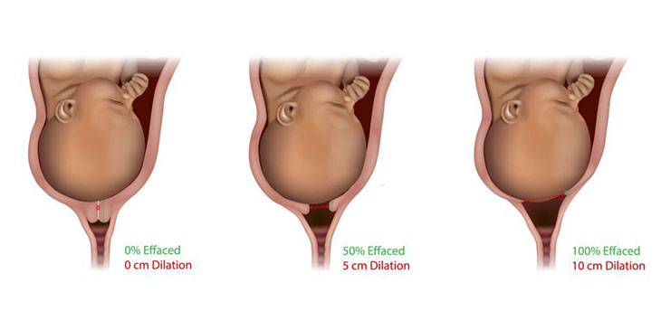 what can i do to induce labor