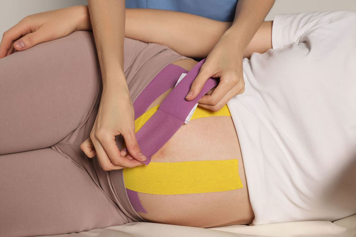 what is spider tape for pregnancy