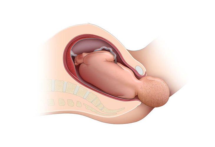 is labor induction safe