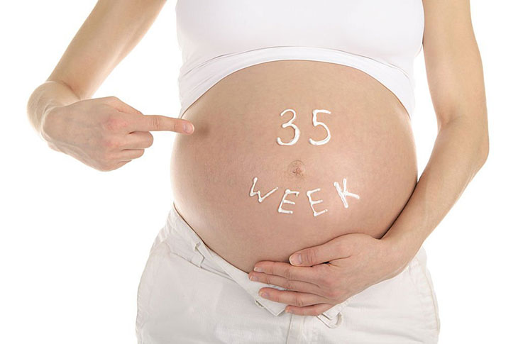 reasons to induce labor at 35 weeks