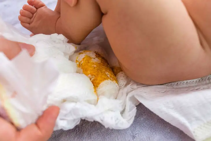When Should You Worry About Baby Poop Smell 