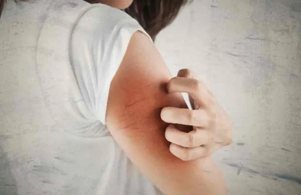 Is Dry Skin a Sign of Pregnancy